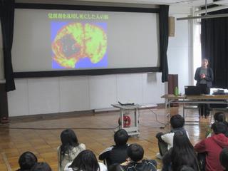 薬物に侵された脳の写真