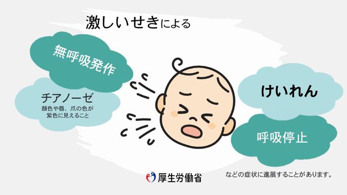 百日咳イラスト