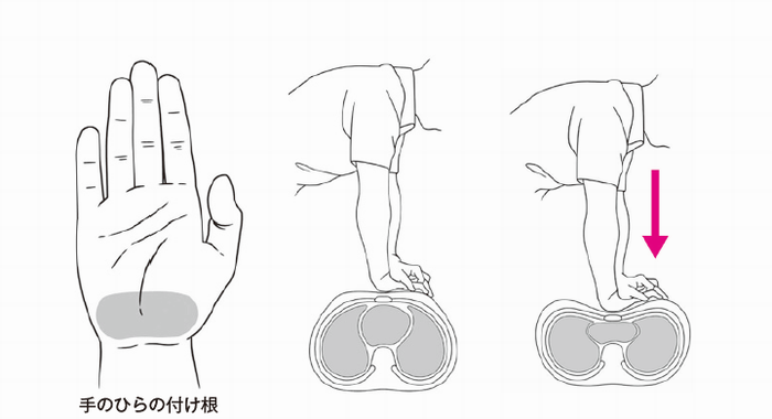 圧迫方法