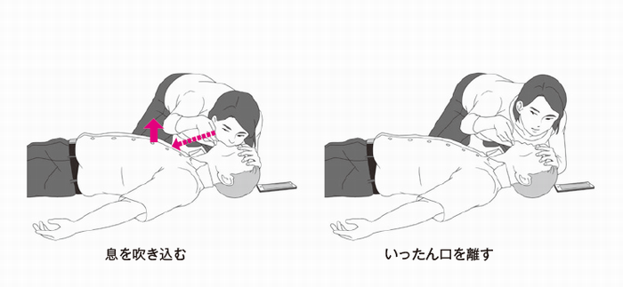 人工呼吸